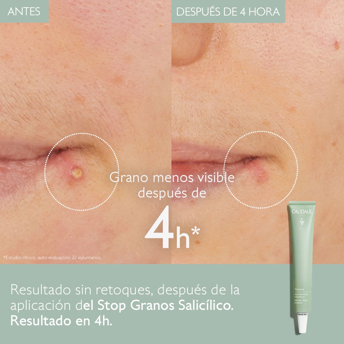 2 vinopure stop boutons before after caudalie es
